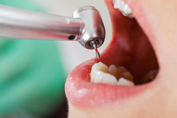 Best Emergency Treatment for Dental Infections or Abscesses in Smithsburg, MD